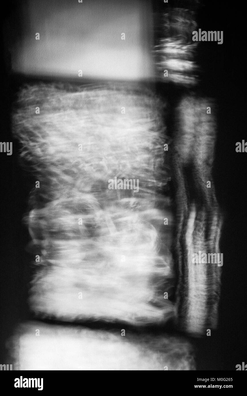 Schwarz und Weiß der abstrakten Mustern auf Wand aus dem Fenster Licht Stockfoto