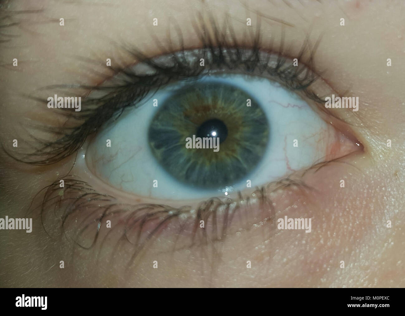 Eine weibliche Person mit zentraler Heterochromie, ein Zustand, bei dem jedes Auge zwei verschiedene Farben hat. In diesem Fall ist ein Auge blau und das andere Haselnussbraun. Dieser seltene und faszinierende Zustand verleiht dem Individuum ein unverwechselbares Aussehen mit einem auffälligen Kontrast zwischen den Augenfarben. Stockfoto