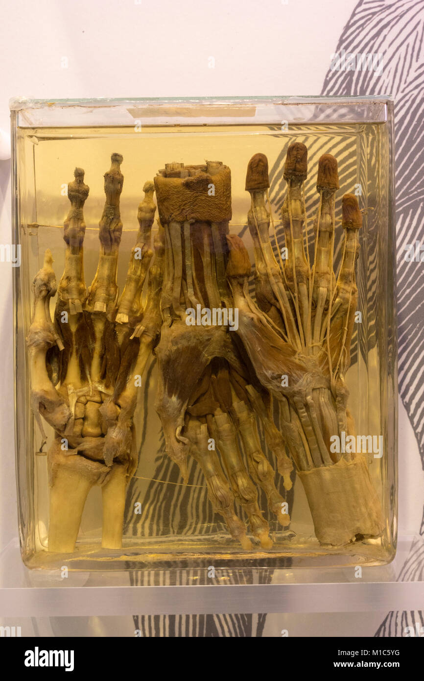 Menschliche Hände anzeigen Muskeln und Bänder auf Anzeige im Nationalen Museum für Gesundheit und Medizin, Silver Spring, MD, USA. Stockfoto