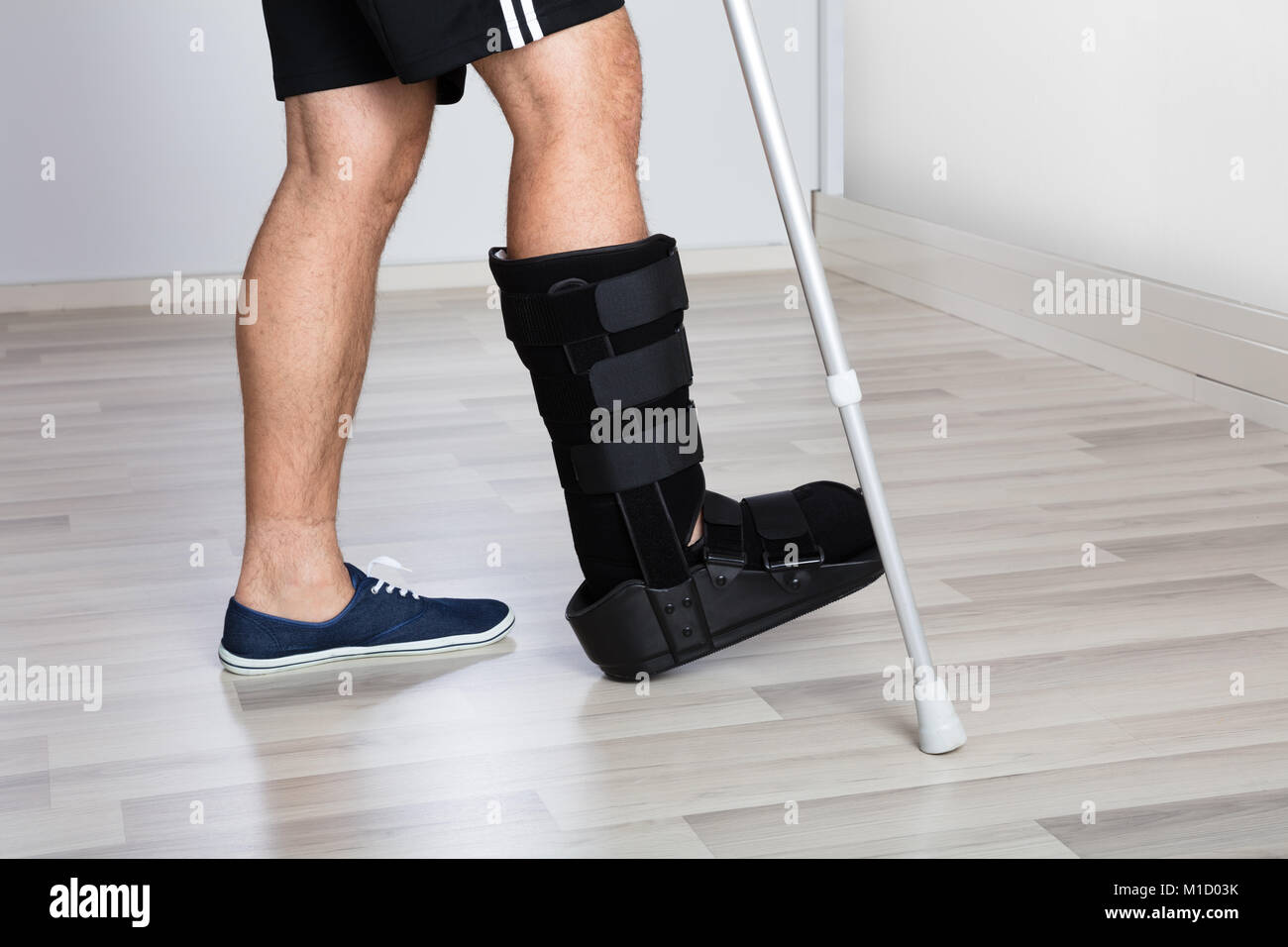 Niedrige Abschnitt Ansicht einer verletzten Person's Bein mit Krücken und Fuß Bandage Stockfoto