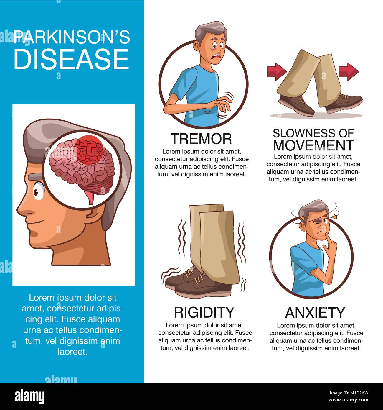 Parkinson Disease Stockfotos & Parkinson Disease Bilder Alamy