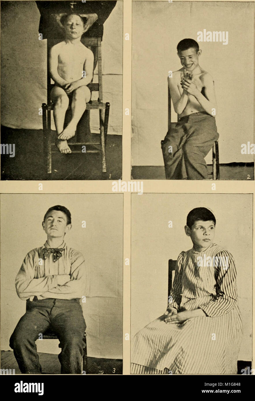 Ein Amerikanischer text-Buch der Krankheiten der Kinder (1895) (14595706880) Stockfoto
