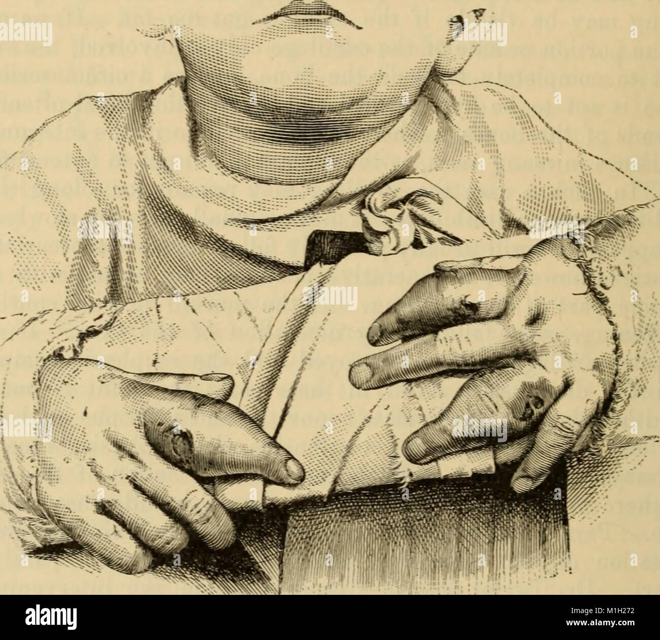 Dieses 1895 Lehrbuch bietet umfassende Informationen über pädiatrische Erkrankungen, deren Symptome, Behandlungen und medizinisches Management und dient als wichtige Ressource für Gesundheitsfachkräfte der damaligen Zeit. Stockfoto