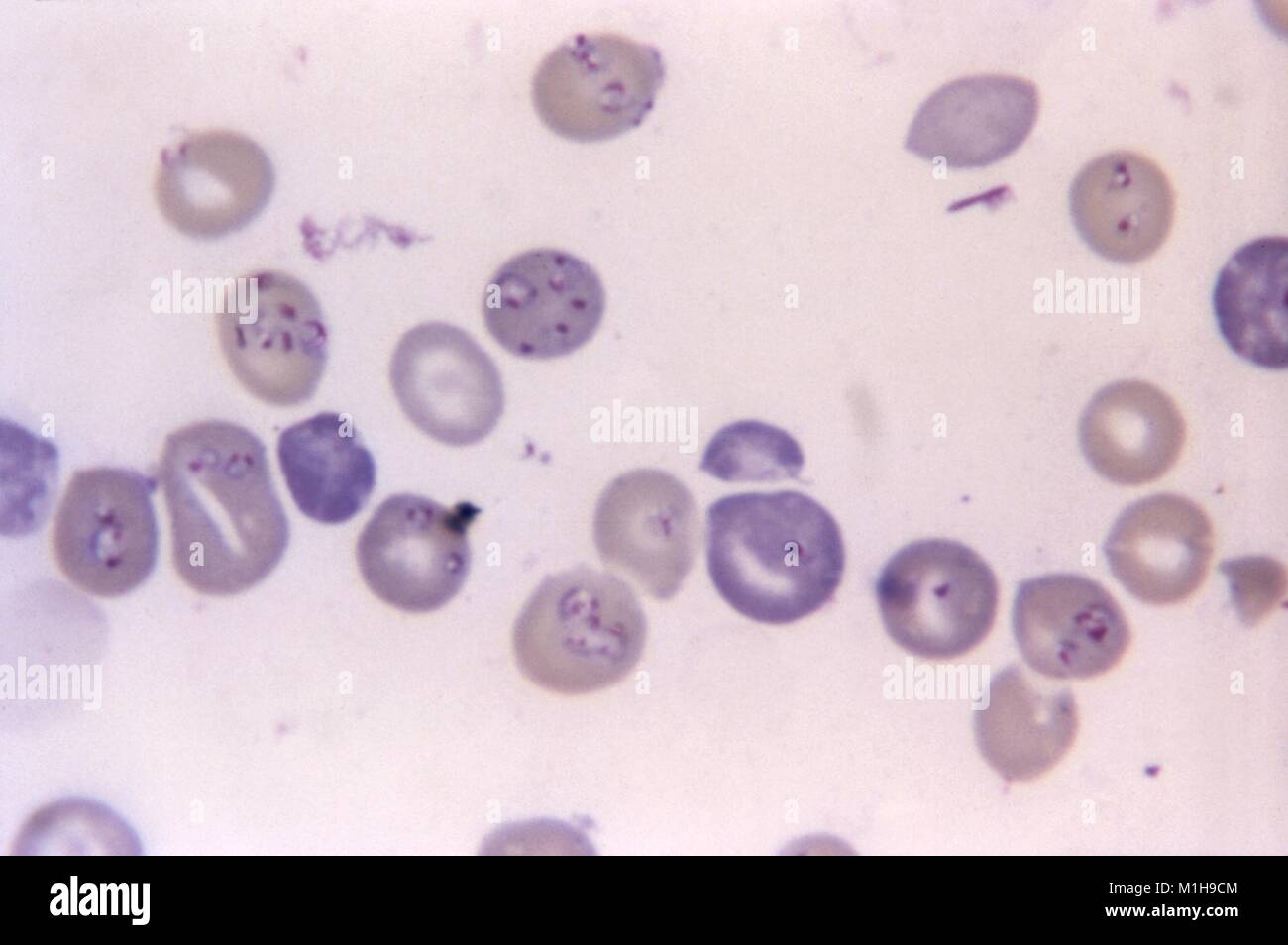 Babesia microti und Plasmodium berghei in den roten Blutkörperchen mit Giemsa zeigte gebeizt, 1972. Mit freundlicher Seuchenkontrollzentren (CDC)/Dr George Healy. () Stockfoto