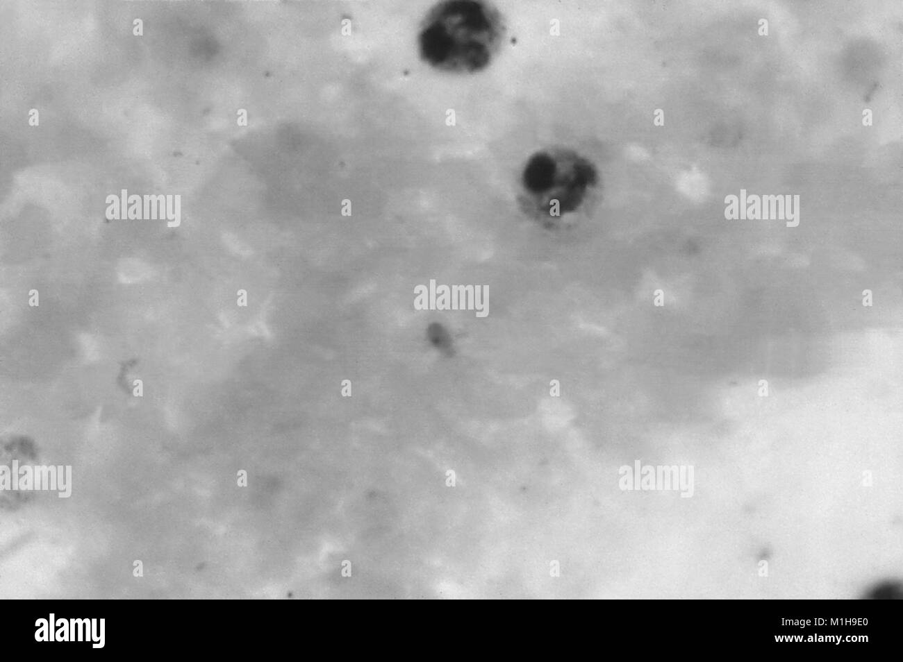 Parasit abgerundete kalten Spore in einer dicken Schliffbild film, 1965 aufgedeckt. Mit freundlicher Seuchenkontrollzentren (CDC)/Dr Mae Melvin. () Stockfoto