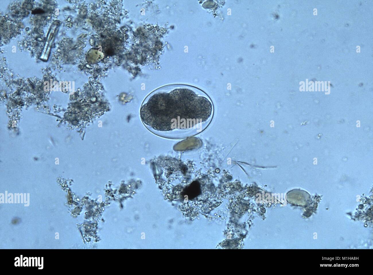 Photomicrograph eines hookworm Ei aus einem nicht bestimmbaren Arten von Herkunft, die intestinale Probleme in den Menschen, 1986 verursachen kann. () Stockfoto