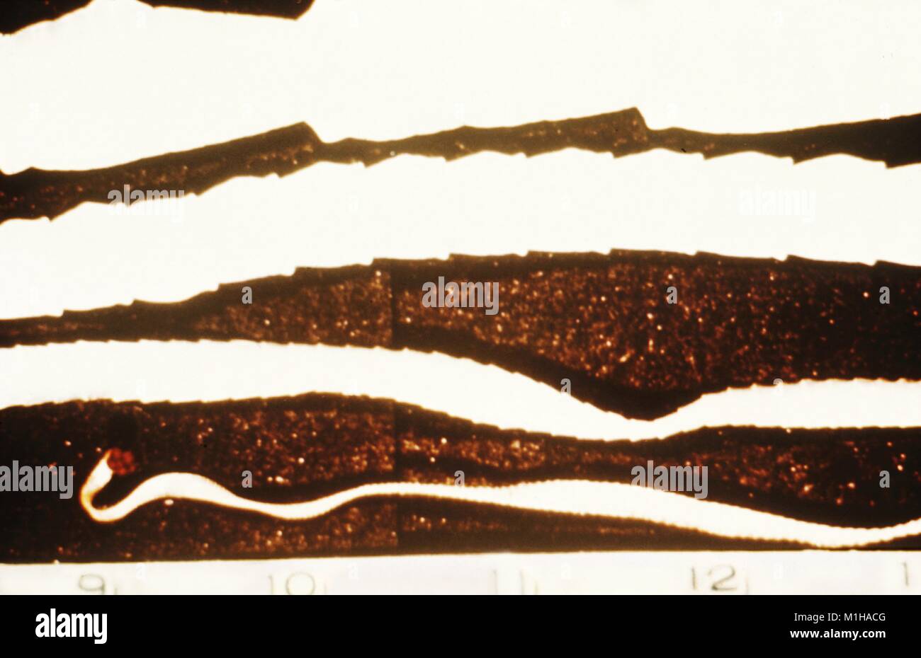 Foto eines reifen Rindfleisch Bandwurm (Taenia saginata), mit einer typischen Länge von 5 Metern und sichtbaren strobila Segmentierung mit reproduzierbaren proglottids, 1979. Mit freundlicher CDC. () Stockfoto