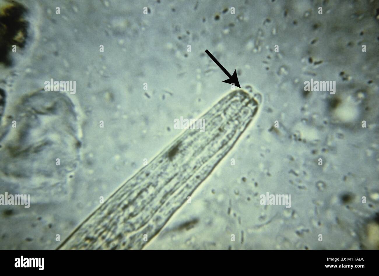Photomicrograph mit eine detaillierte Ansicht der kurzen Wangentasche Morphologie in der rhabditiform (Noninfectious) Larvenstadium einer Strongyloides Arten nematode (fadenwurm), 1979. Mit freundlicher CDC. () Stockfoto