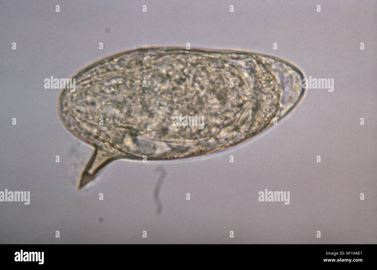 Photomicrograph einer Eizelle aus dem Parasiten Schistosoma mansoni mit seiner charakteristischen seitlichen Wirbelsäule in der Nähe der hinteren Ende, 1979. Mit freundlicher CDC. () Stockfoto