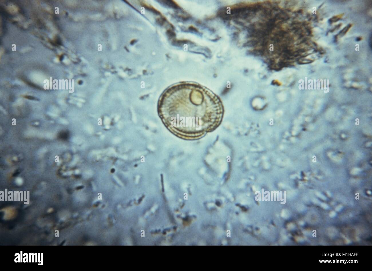 Photomicrograph eines pollen Granulat, die sehr oft für eine parasitäre Ei, 1979 ein Irrtum ist. Mit freundlicher CDC. () Stockfoto