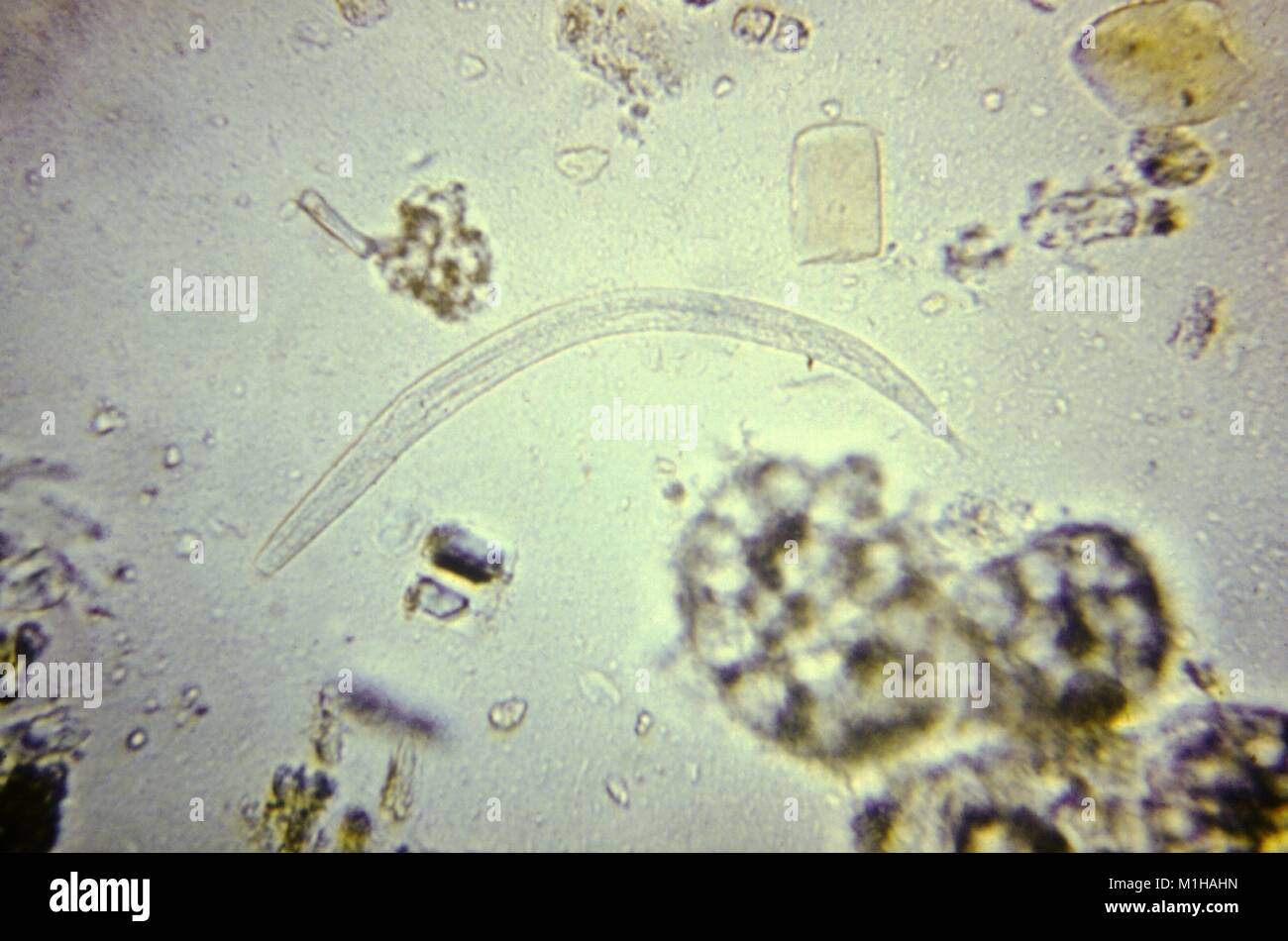 Photomicrograph einer parasitären Strongyloides Arten nematode (fadenwurm) Larve, in seiner rhabditiform (nonifectious) Bühne, 1979. Mit freundlicher CDC. () Stockfoto