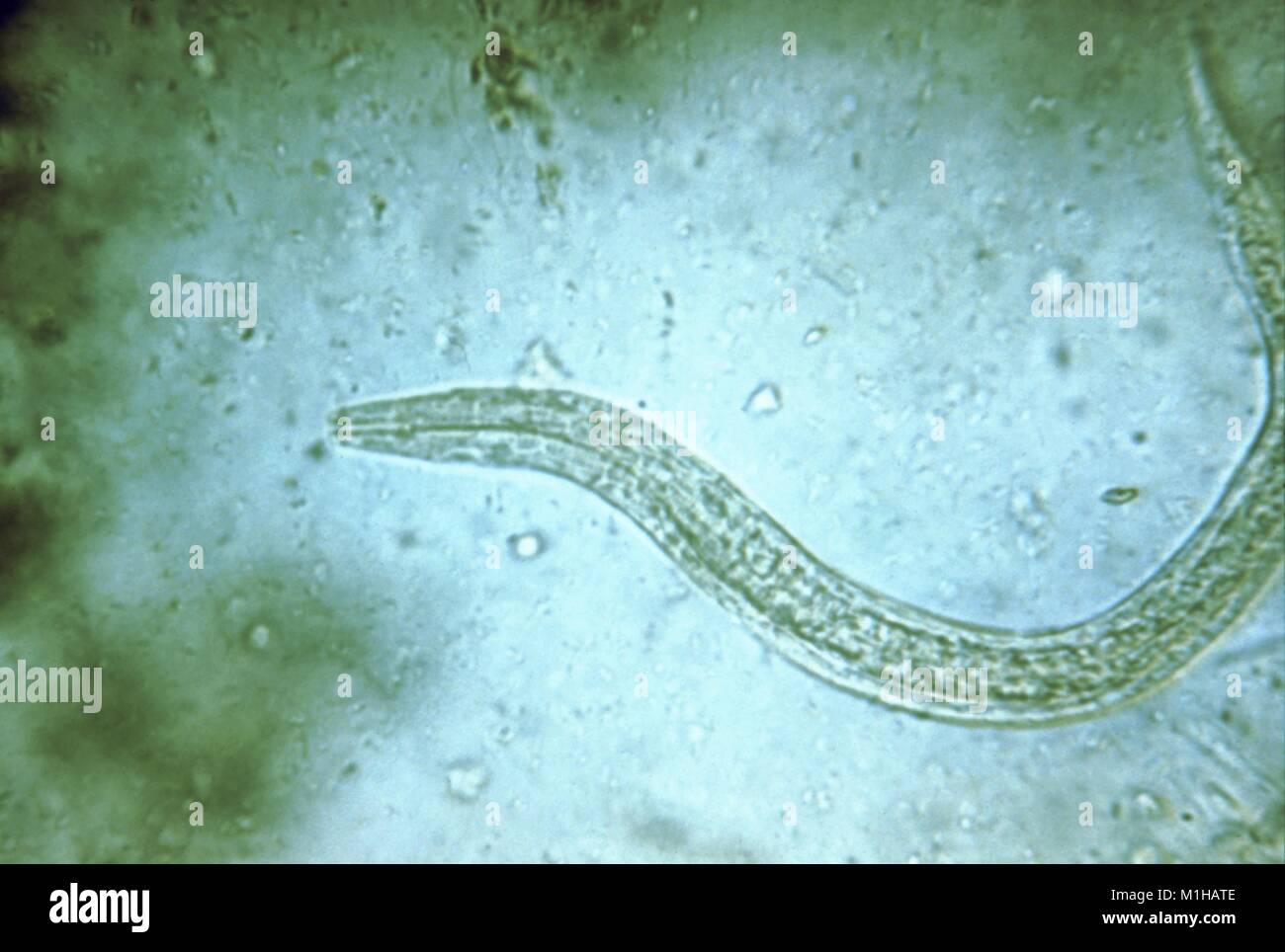 Photomicrograph der menschlichen hookworm (Ancylostoma duodenale, Necator americanus) rhabditiform Larve, die seine frühen noninfectious Bühne, 1979. Mit freundlicher CDC. () Stockfoto