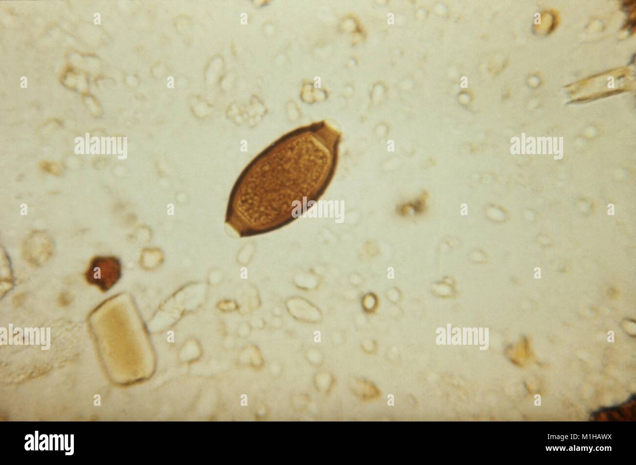 Photomicrograph der menschlichen Madenwurm (Trichuris trichiura) Eier, die die Krankheit Trichuriasis, 1979 verursachen. Mit freundlicher CDC. () Stockfoto