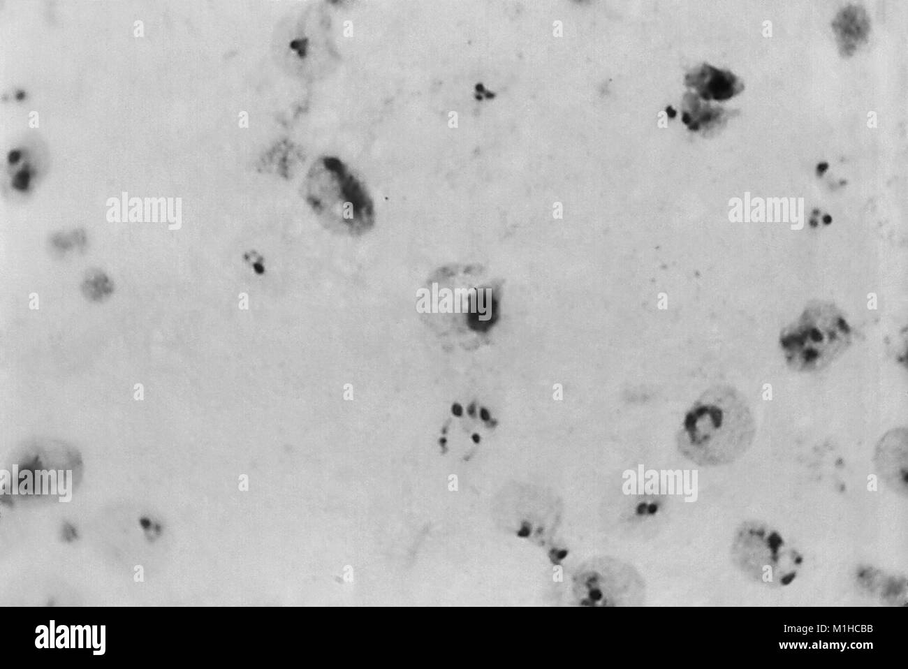 Plasmodium vivax trophozoite in einer dicken photomicrograph Film offenbart, mit Giemsa Fleck, 1973. Mit freundlicher Seuchenkontrollzentren (CDC)/Dr Mae Melvin. () Stockfoto