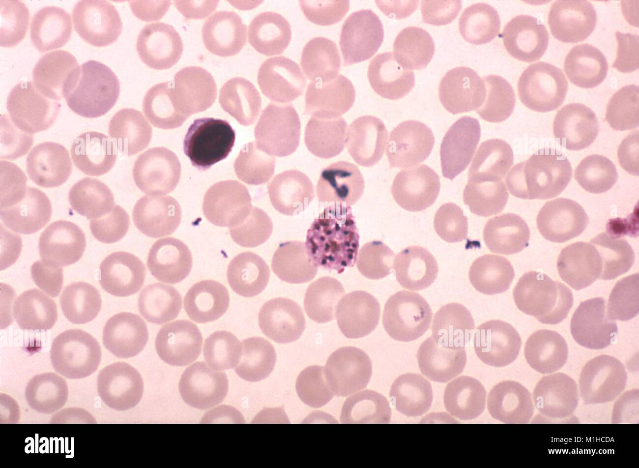 20 merozoiten Plasmodium vivax schizont in dicken Schliffbild Film mit Giemsa Fleck, 1977 aufgedeckt. Mit freundlicher Seuchenkontrollzentren (CDC)/Dr Mae Melvin. () Stockfoto