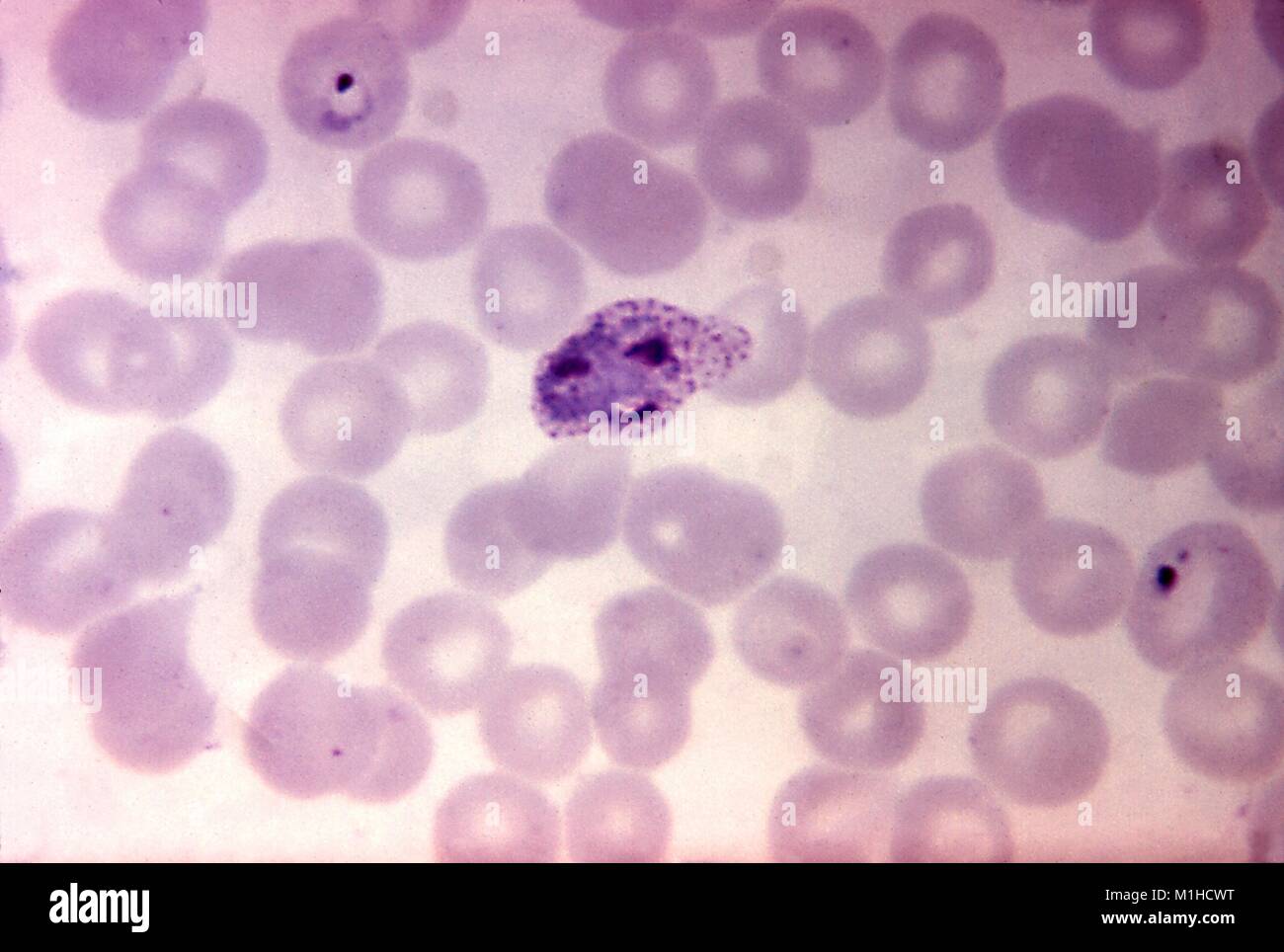 Photomicrograph der Malaria verursachen Parasiten Plasmodium vivax in ihrer Unreife schizont Phase, vergrößerte 1125 x, 1970. Mit freundlicher CDC. () Stockfoto
