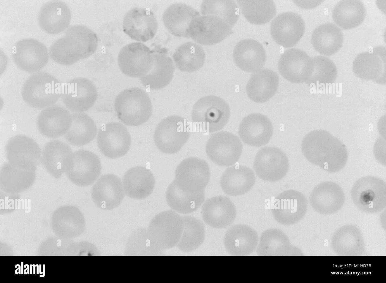 Photomicrograph des Malariaparasiten Plasmodium vivax im Ring Phase mit Chromatin Masse in seiner Mitte, auf Giemsa angefärbt thin film, 1125 x, 1973. Bild mit freundlicher Genehmigung von CDC/Dr. Mae Melvin. () Stockfoto