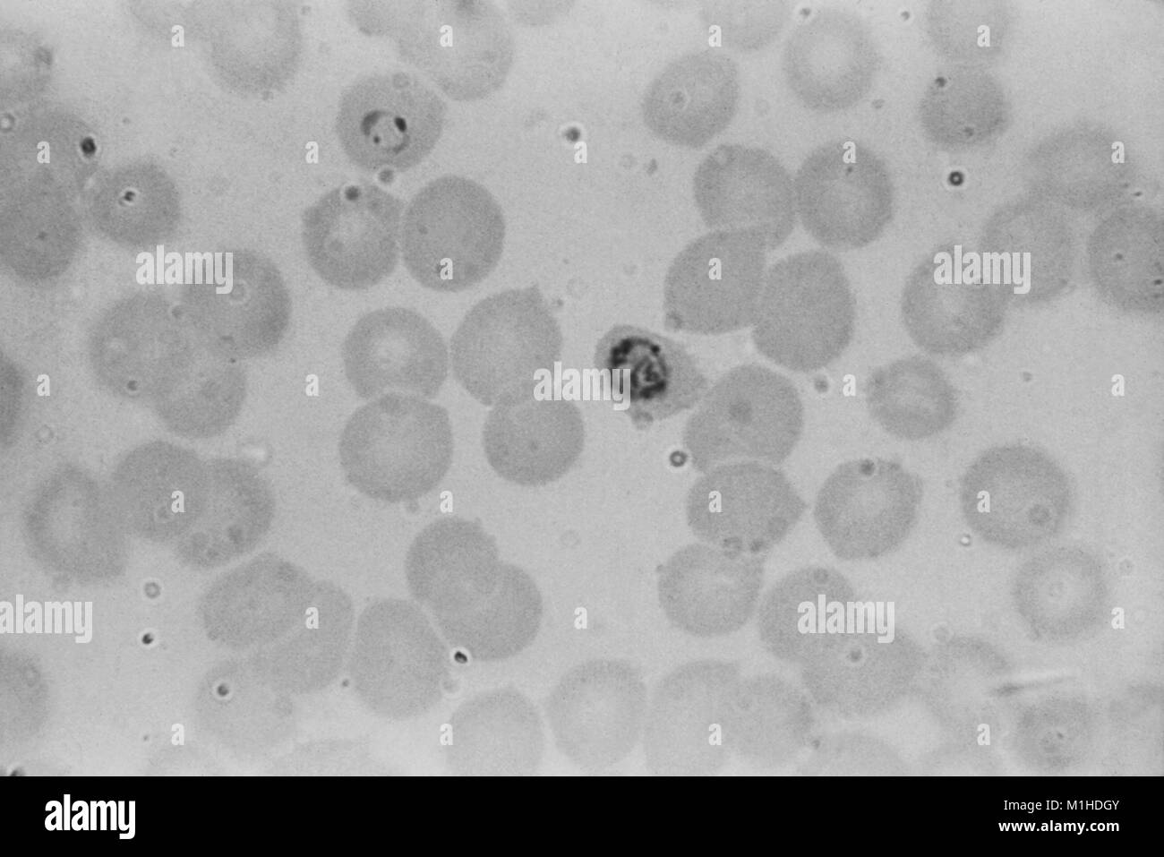 Photomicrograph eines unreifen Plasmodium falciparum schizont und einen Ring bilden, Teile der Parasit, der Malaria, 1963 verursacht. Mit freundlicher CDC/N. J. Wheeler, Jr. () Stockfoto