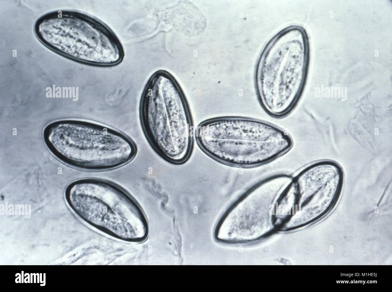 Rundwürmer (Enterobius vermicularis) Nematoden Eier in den photomicrograph Film, 1982 aufgedeckt. Mit freundlicher Seuchenkontrollzentren (CDC). () Stockfoto