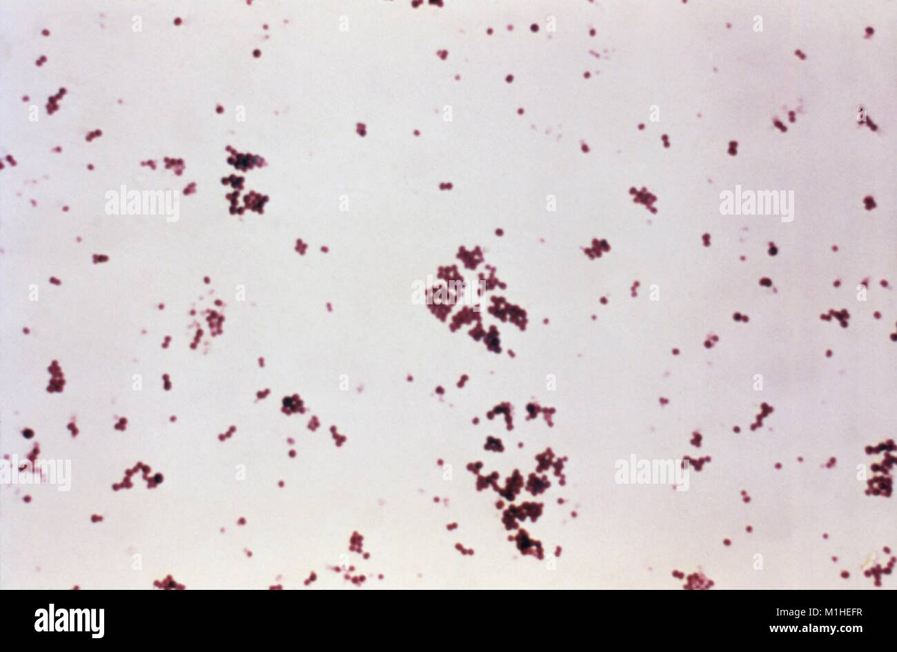 Photomicrograph von Staphylococcus aureus-Bakterien, einem Erreger der Toxischen Schocksyndrom (TSS), auf einem Gram-gebeizt bestreichen, 1984. Mit freundlicher CDC. () Stockfoto