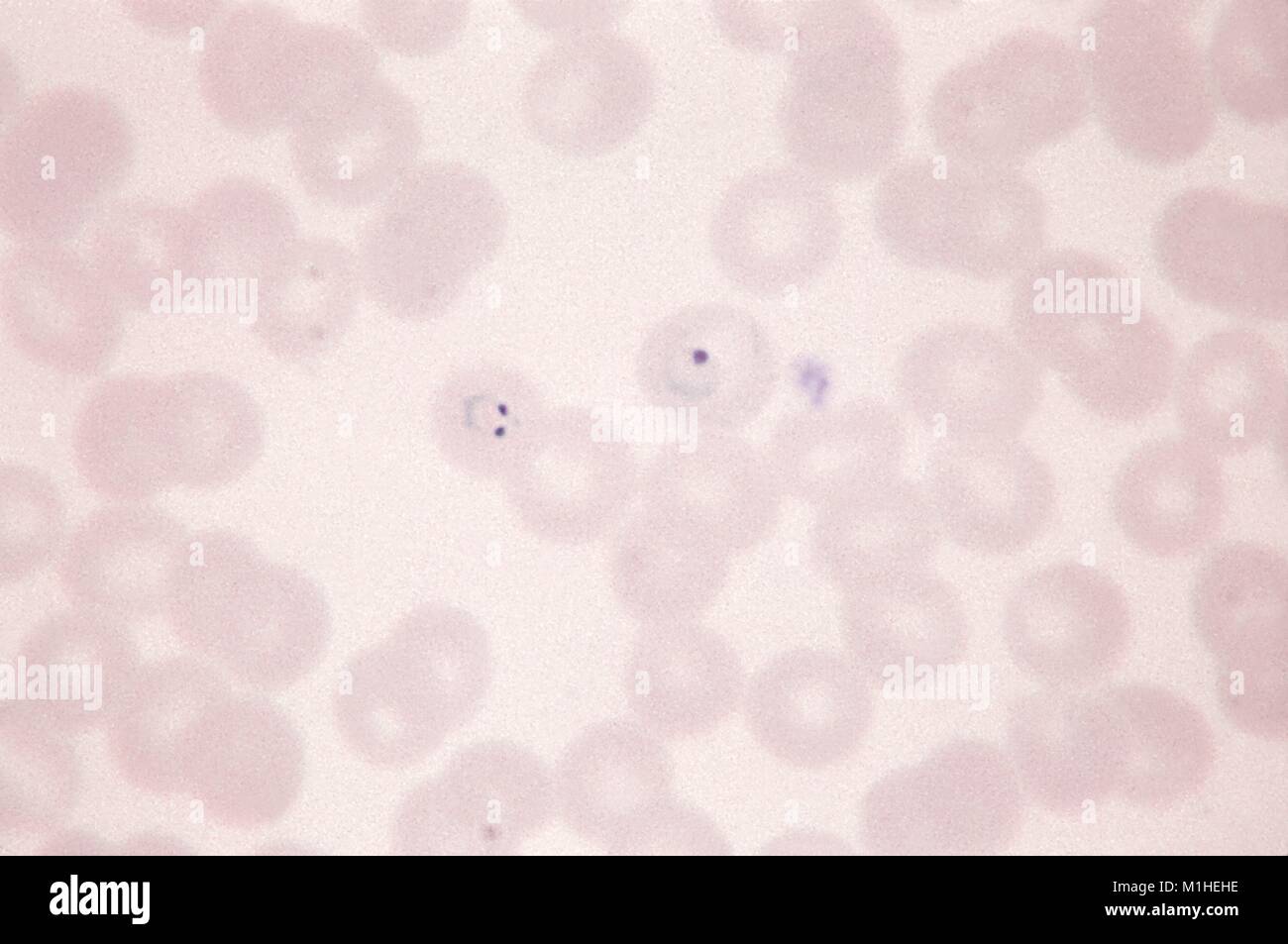Photomicrograph des Malariaparasiten Plasmodium vivax in zwei Formen mit unterschiedlichen morphologischen Merkmale, auf dünnen Blutausstrich vergrößerte 1125 x, 1966. Bild mit freundlicher Genehmigung von CDC/Dr. Mae Melvin. () Stockfoto