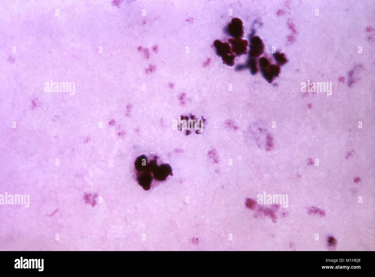 Photomicrograph des Malariaparasiten Plasmodium malariae in seiner reifen Phase schizont, 1965. Bild mit freundlicher Genehmigung von CDC/Dr. Mae Melvin. () Stockfoto