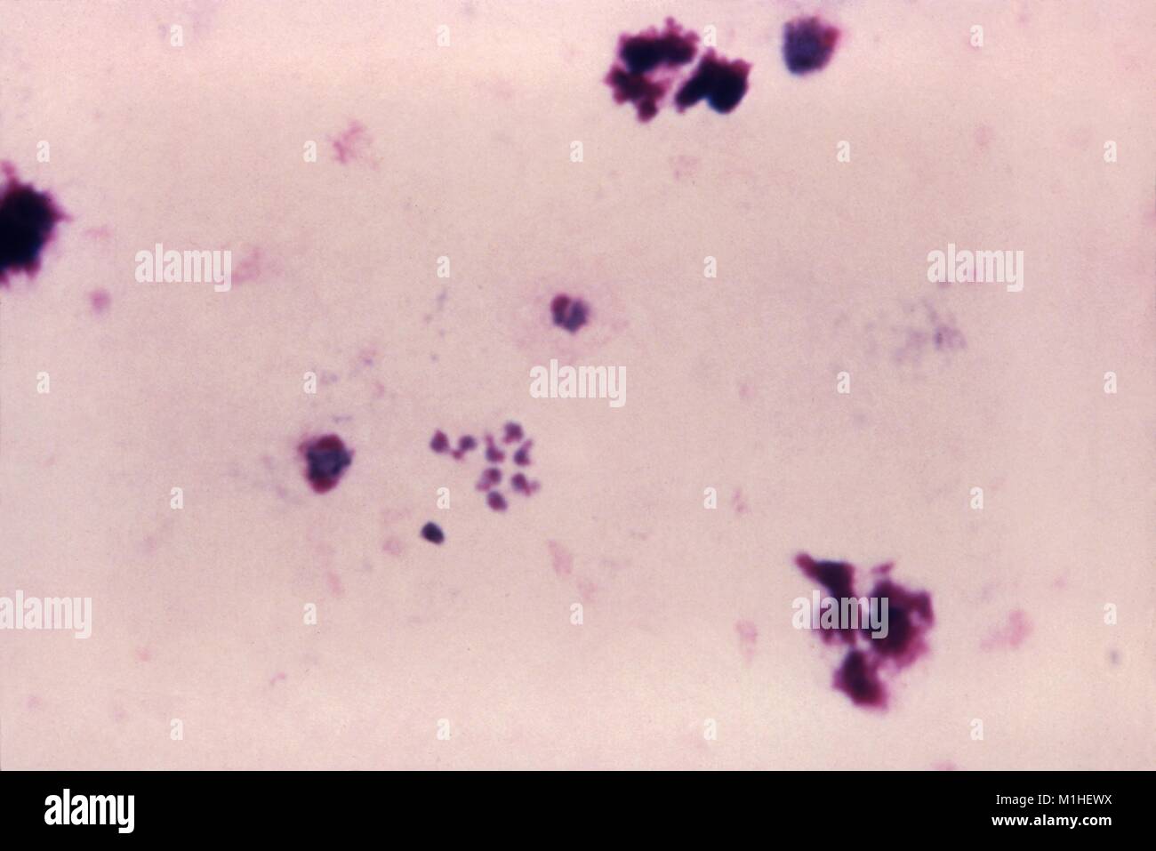 Photomicrograph des Malariaparasiten Plasmodium ovale in den verschiedenen Stadien der schizonts und merozoiten, auf dicke Folie Blutausstrich, 1966. Bild mit freundlicher Genehmigung von CDC/Dr. Mae Melvin. () Stockfoto