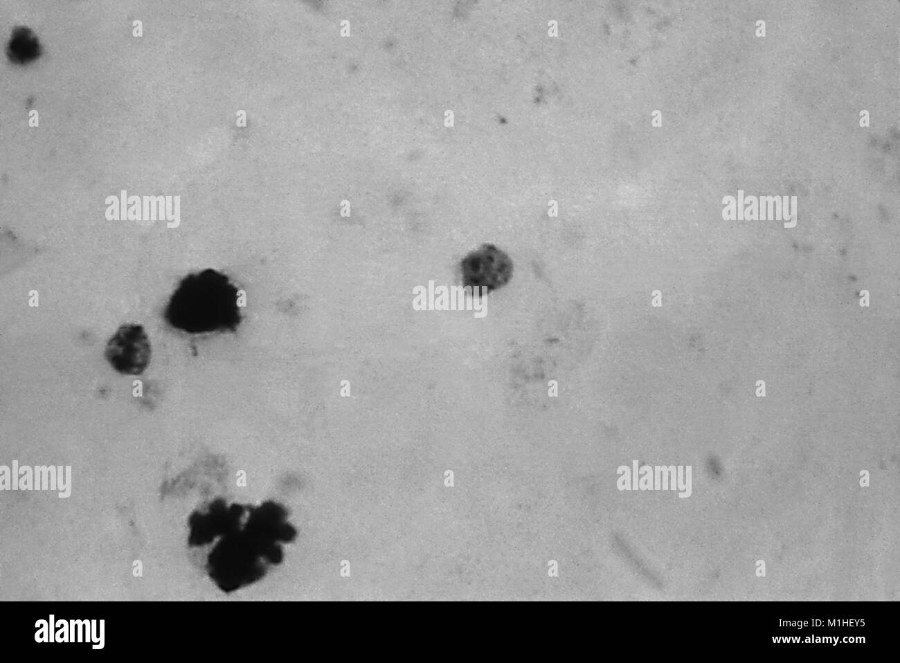 Photomicrograph des Malariaparasiten Plasmodium malariae in trophozoite Phase mit prominenten Pigmentierung, auf einem dicken Blutausstrich, 1965. Bild mit freundlicher Genehmigung von CDC/Dr. Mae Melvin. () Stockfoto
