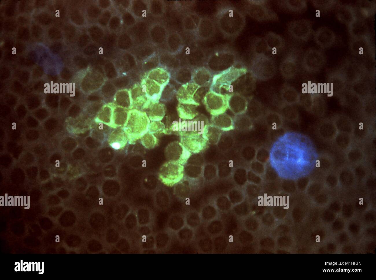 Eine photomicrograph Bild von Herpes Virus Antikörper nachgewiesen mit Immunofluoreszenz-muster Färbung Technik, 1977. Bild mit freundlicher Genehmigung von CDC/Dr. Craig Lyerla. () Stockfoto