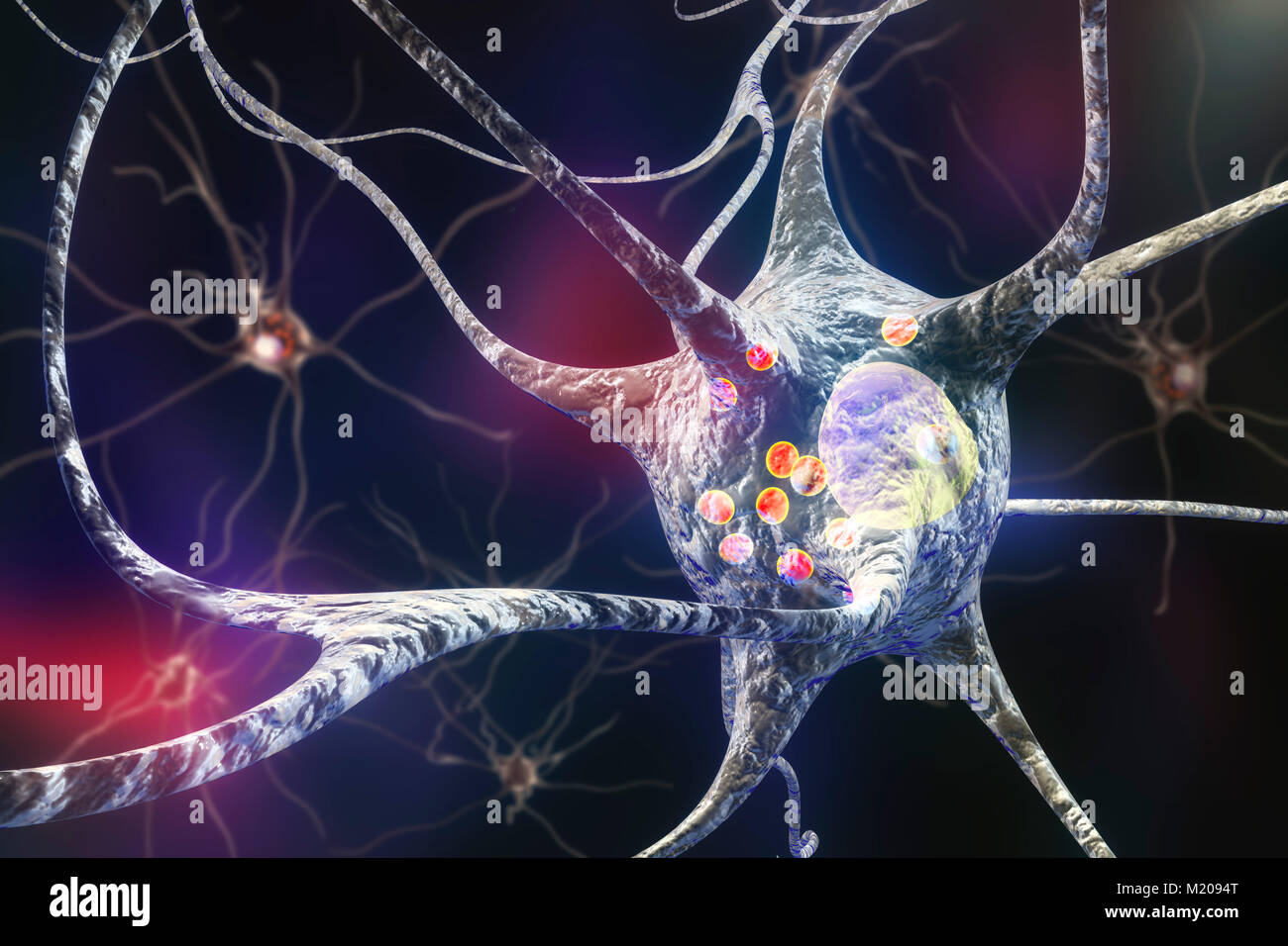 Parkinson Nervenzellen. Computer Abbildung von menschlichen Nervenzellen von Lewy Körpern (kleine rote Kugeln im Zytoplasma der Nervenzellen) im Gehirn eines Patienten mit der Parkinsonschen Krankheit betroffen. Lewy Körpern sind abnormale Ansammlungen von Protein, das in Nervenzellen bei der Parkinson-krankheit entwickeln, Lewy-Körperchen-Demenz und anderen neurologischen Erkrankungen. Stockfoto
