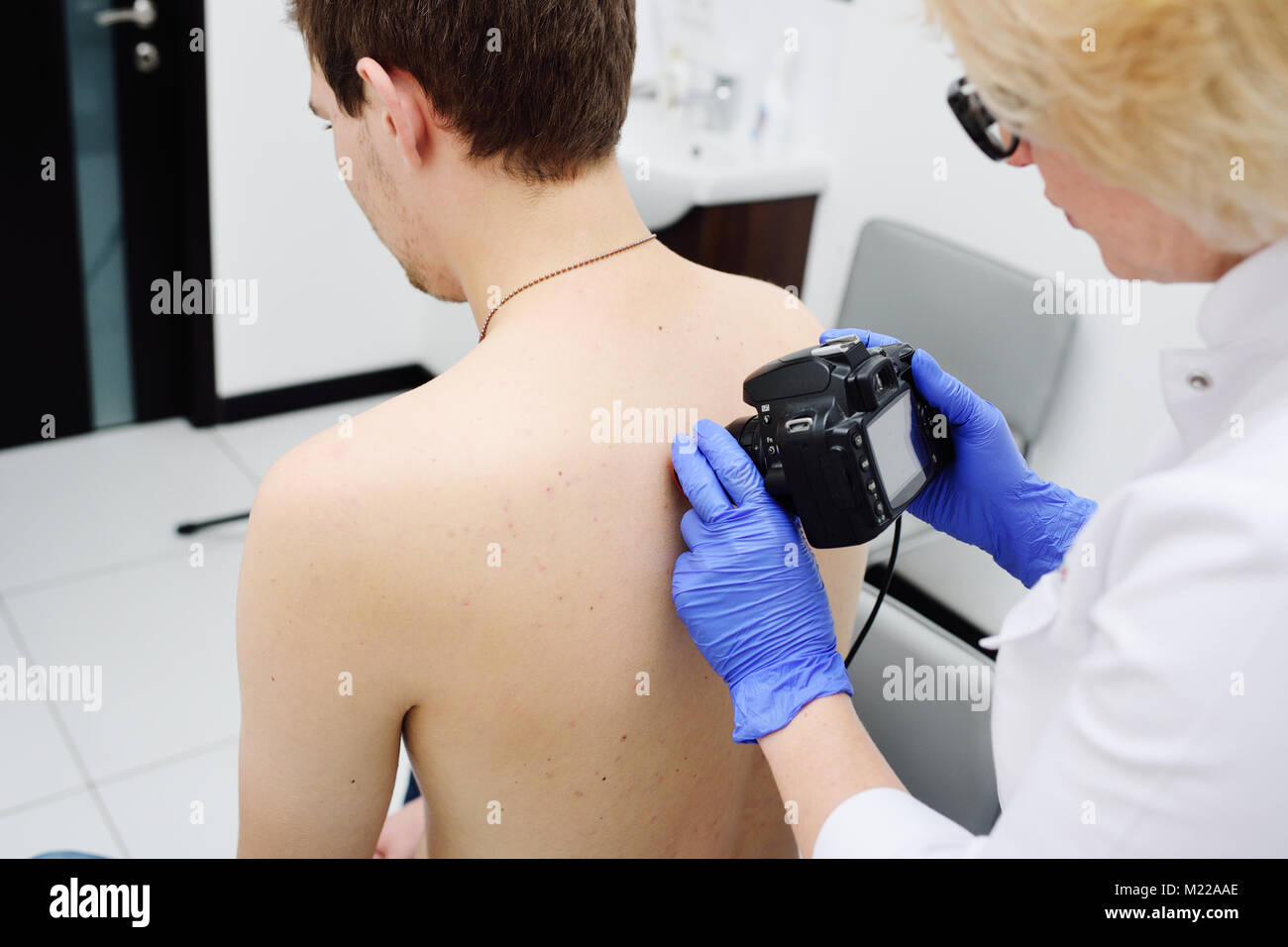 Der Arzt Hautarzt untersucht Muttermal und Muttermale des Patienten mit einem dermatoskop Stockfoto