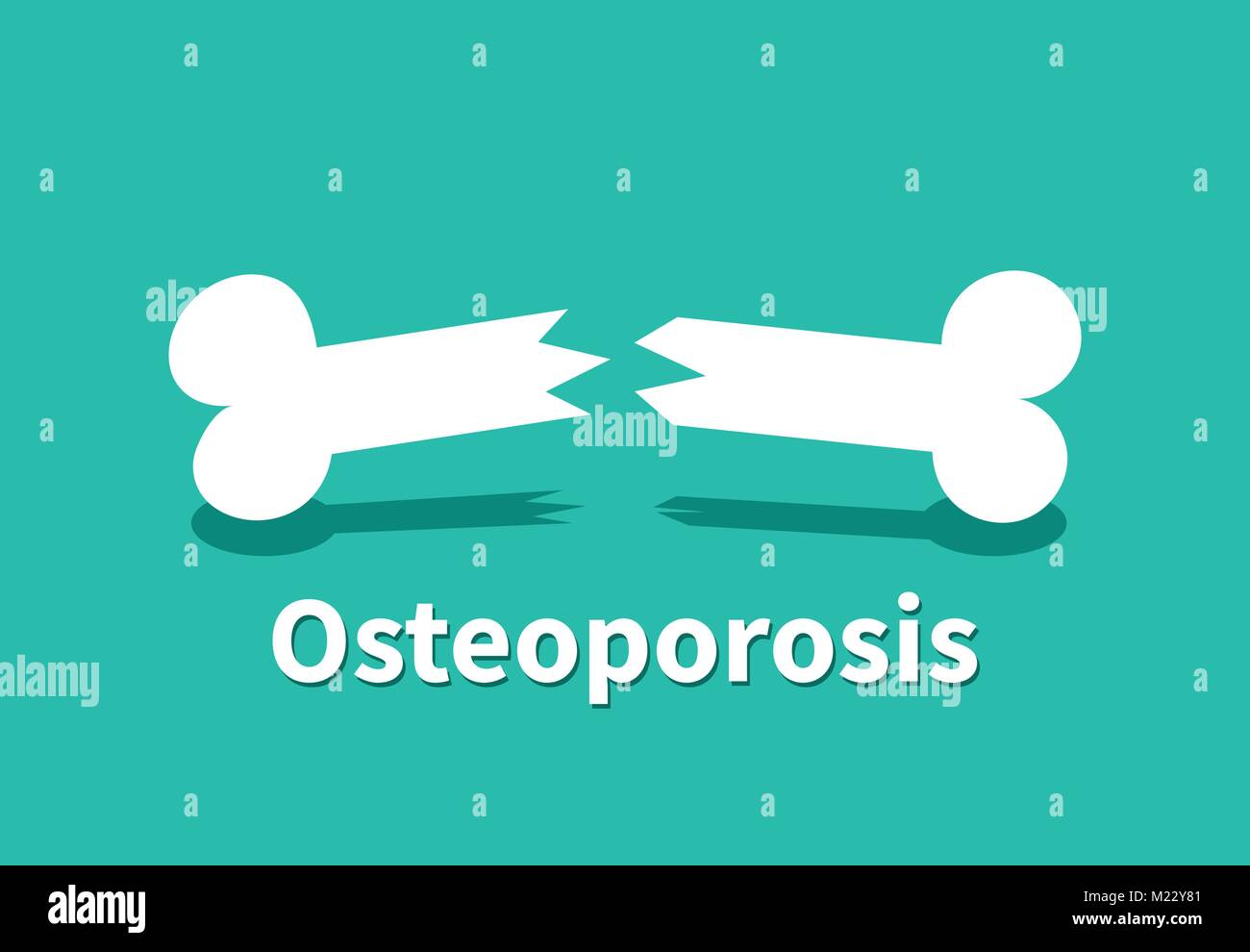 Osteoporose, gebrochenen Knochen in Vector art design Stock Vektor