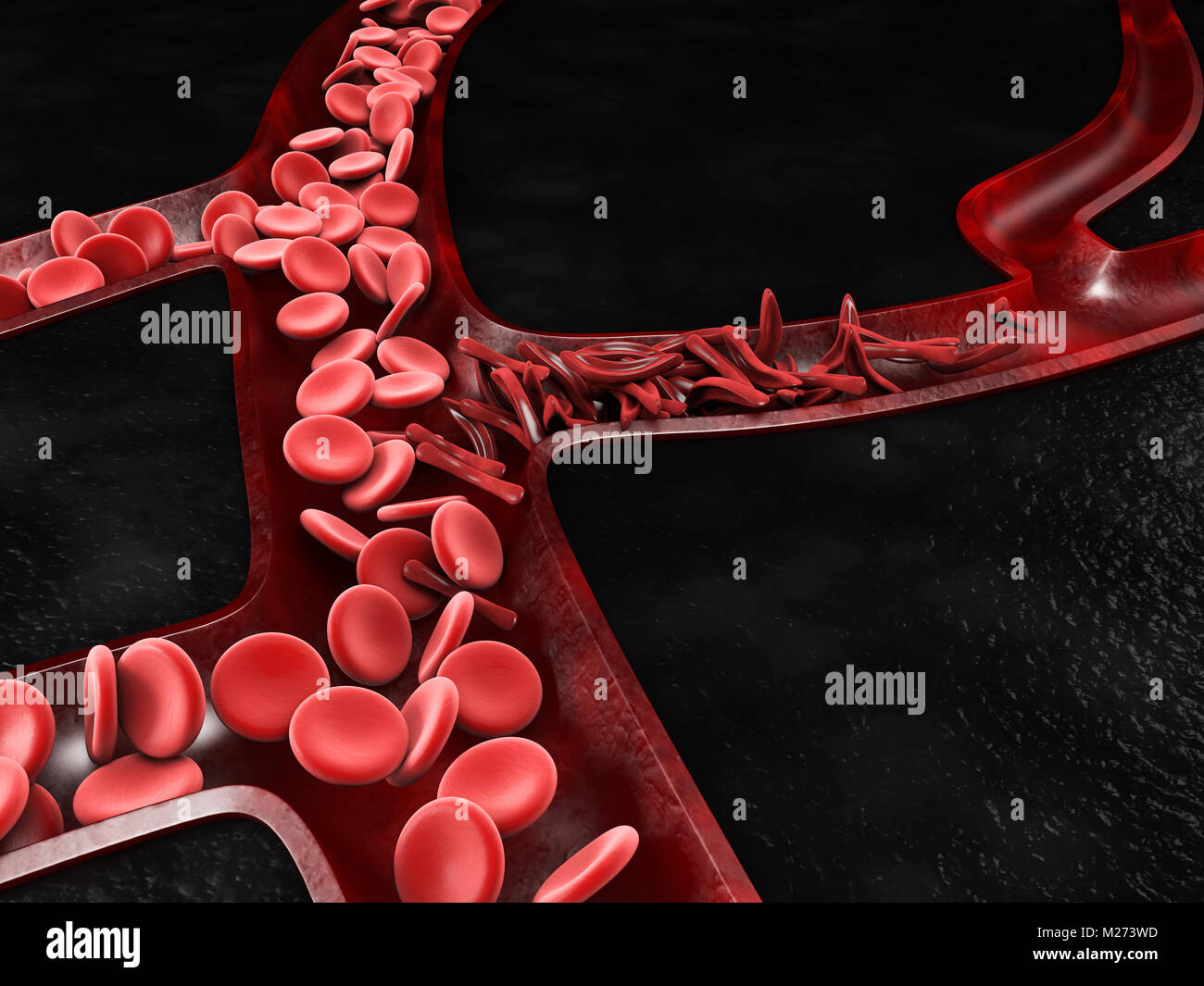 Anämie, Sichelzelle und normale rote Blutkörperchen, 3D-Darstellung. Stockfoto