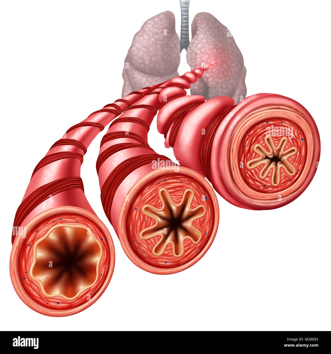 Asthma bronchiale Rohr verengt Atemproblem Konzept durch die atemmuskulatur Anzug und Schwellungen Stadien der Luftweg. Stockfoto