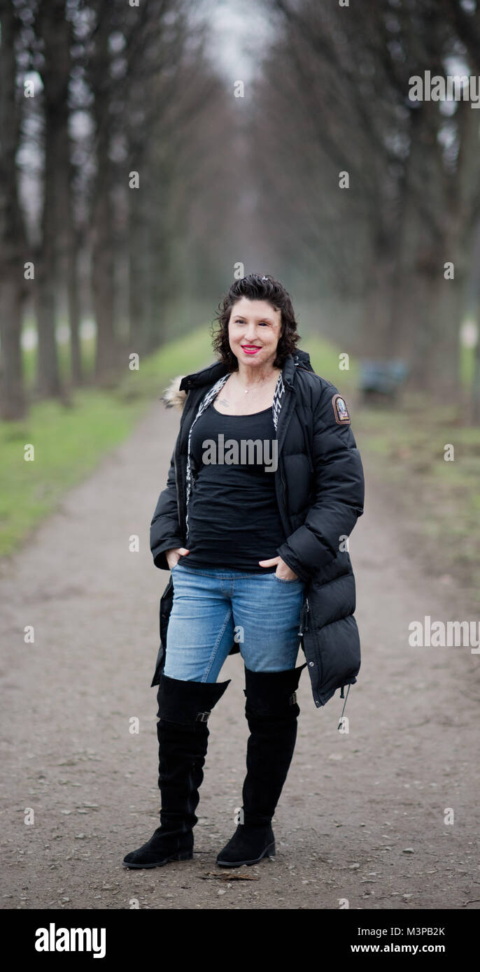 Hannover Deutschland 5 Februar 2018 Vanessa Muenstermann Hat Ihr Bild In Hannover Deutschland Vom 5 Februar 2018 Aufgenommen Vor Zwei Jahren Ihr Ex Freund Ihr Mit Schwefelsaure Angegriffen Und Ihr Fur Das Leben