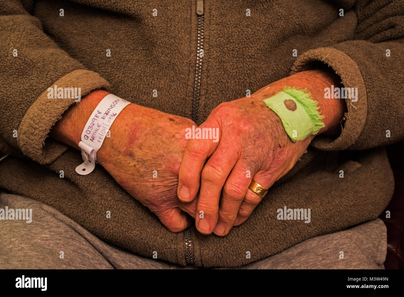 Ältere Patienten mit gequetschten Hände Stockfoto