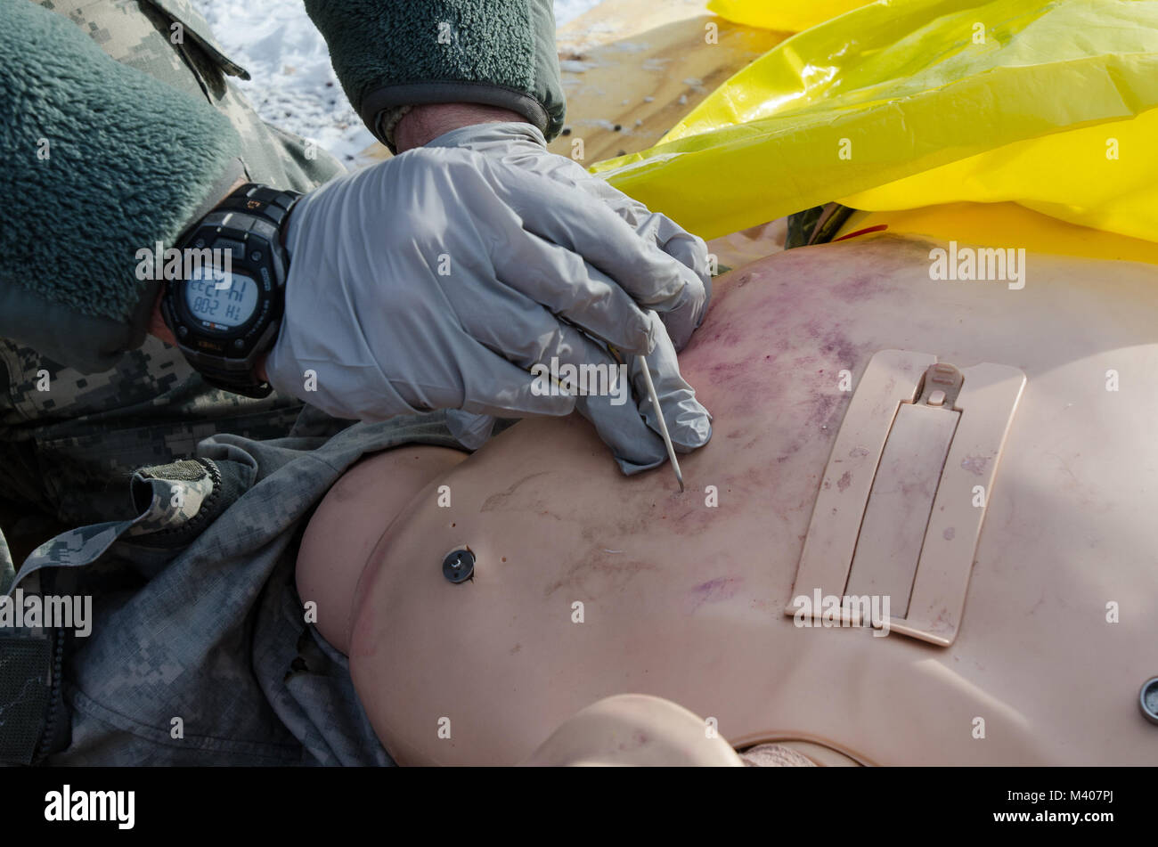 FORT MCCOY, Wis-US Army Reserve SPC. Jonathan Hessel, Sanitäter, Task Force Triade, Betrieb Cold Steel II, führt eine Brust Dekomprimierung auf notfallpatient Simulator während einer medizinischen Evakuierung Probe am Fort McCoy, Wis., Feb 8, 2018. Betrieb Cold Steel ist der US-Armee finden Crew - Serviert Waffen Qualifizierung und Validierung ausüben, um sicherzustellen, dass America's Army Reserve Einheiten und Soldaten ausgebildet sind und bereit, auf kurze bereitstellen - Bekanntmachung als Teil bereit, Kraft X und überall in der Welt bekämpfen - bereit und tödlichen Feuerkraft zur Unterstützung der Armee und unsere gemeinsamen Partner bringen. (U.S. Arm Stockfoto