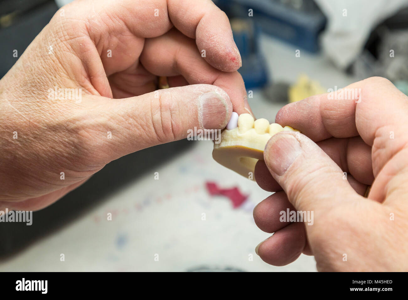 Männliche Zahntechniker arbeitet an einem 3D-gedruckten Form für Zahnimplantate im Labor. Stockfoto