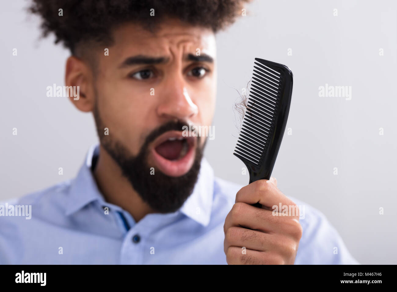 Junger Mann mit Kamm auf Haarausfall Stockfoto