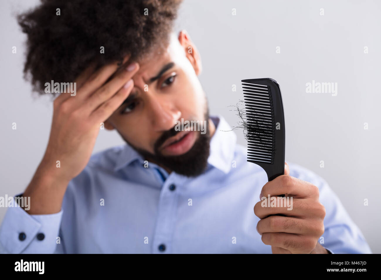 Junger Mann mit Kamm auf Haarausfall Stockfoto