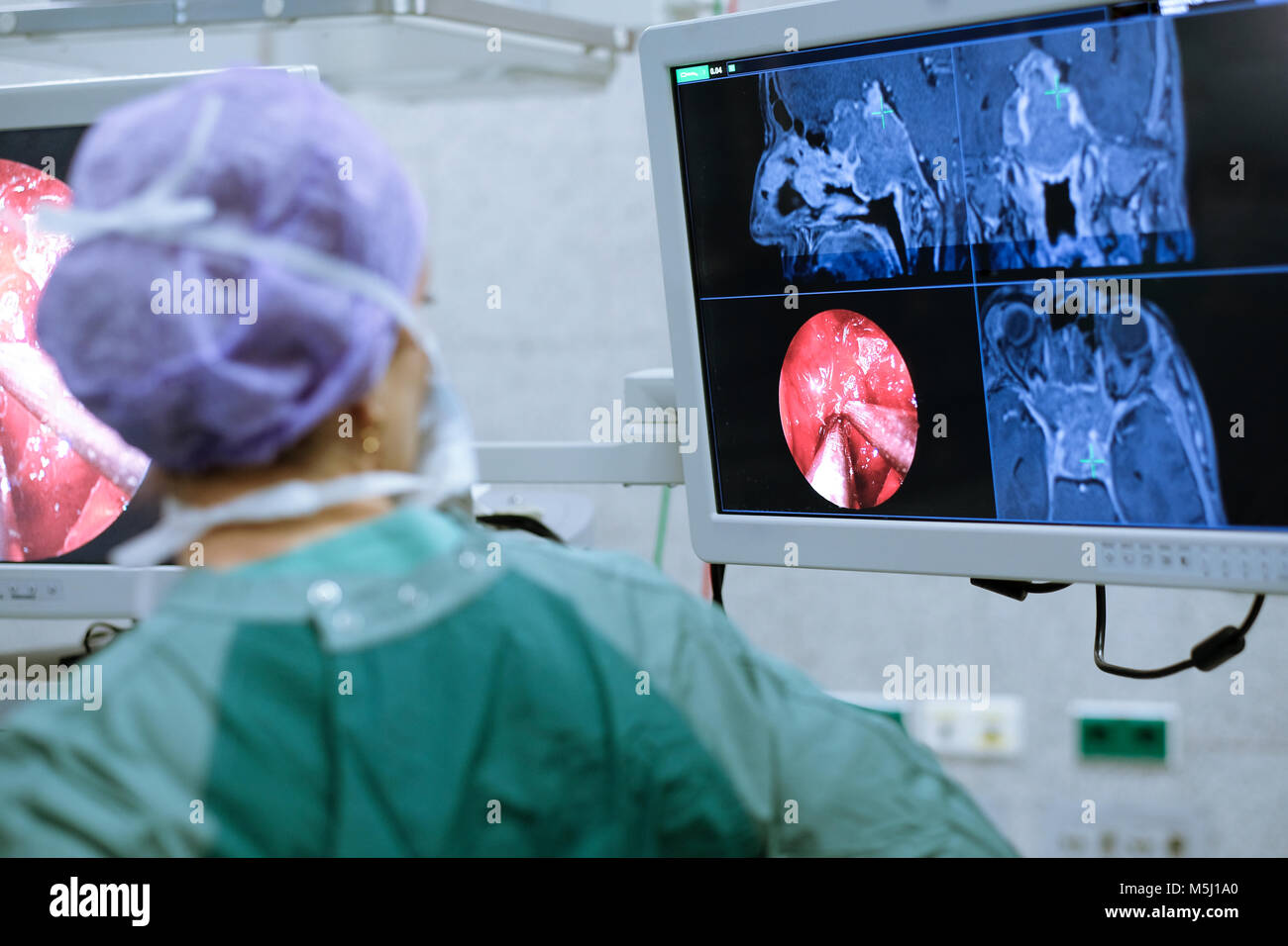 Neurochirurg in Scrubs bei Monitor suchen Stockfoto