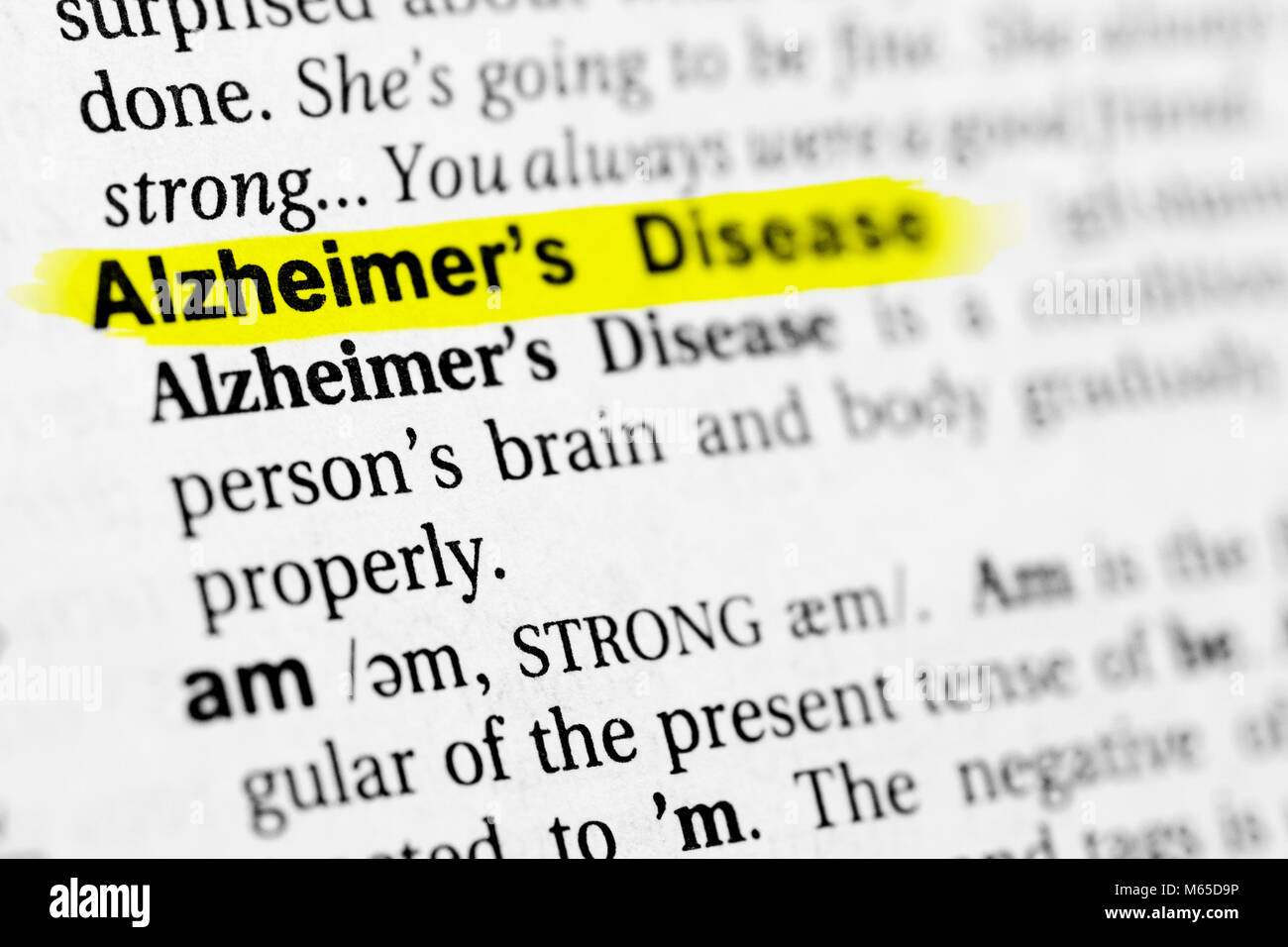 Markierten englische Wort 'Alzheimer' und seine Definition im Wörterbuch. Stockfoto