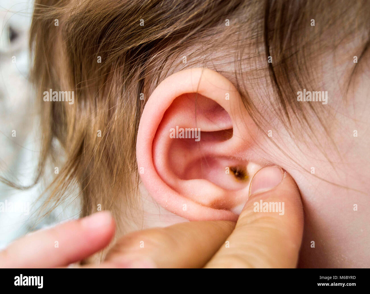 Ohr Bilder, baby Ohren und Ohr Erkrankungen, Arzt, Ohr Stockfotografie -  Alamy