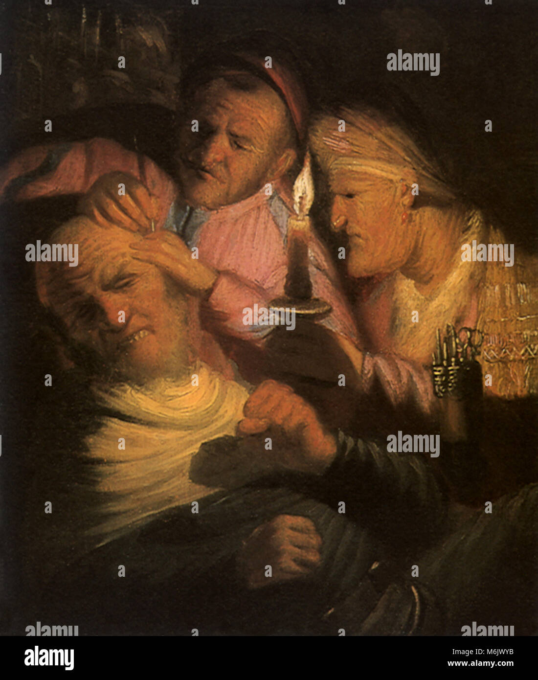 Die Operation, frühe Leyden Anhänger von Rembr, 1628. Stockfoto