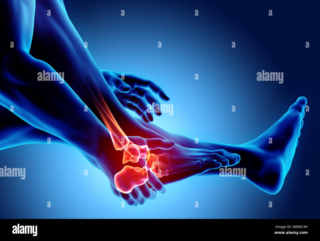Sprunggelenk schmerzhaft - Skelett Röntgen, 3D Illustration medizinisches Konzept. Stockfoto