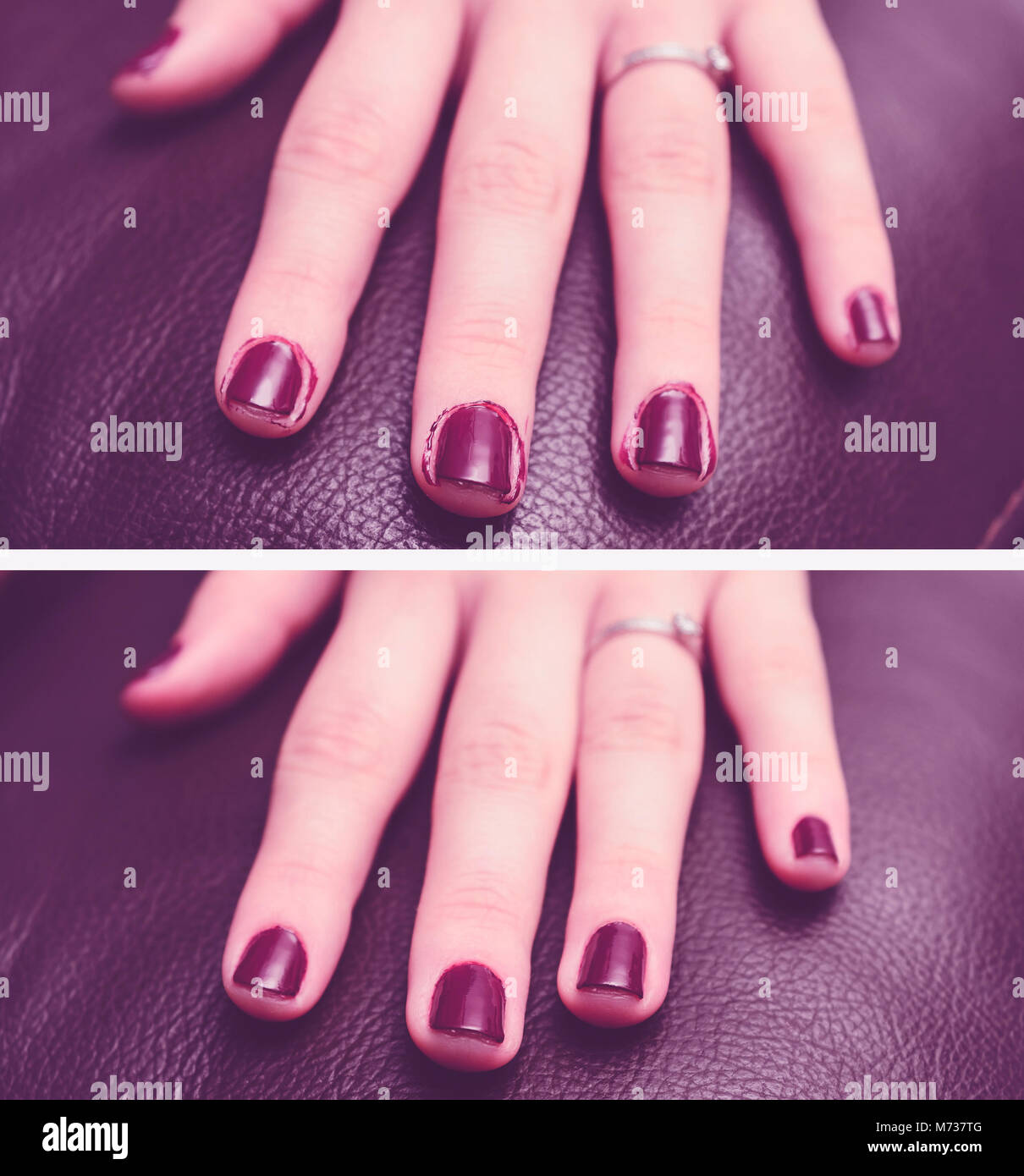 Purple Nail Polish Stockfotos und -bilder Kaufen - Alamy