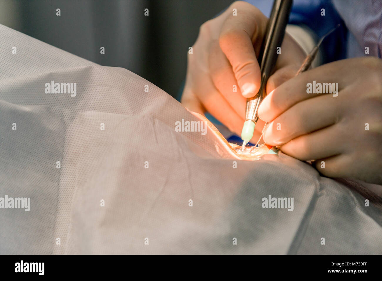 Ärzte sind in den Prozess der Durchführung von Operationen am Auge. Closeup. medizinisches Konzept Stockfoto