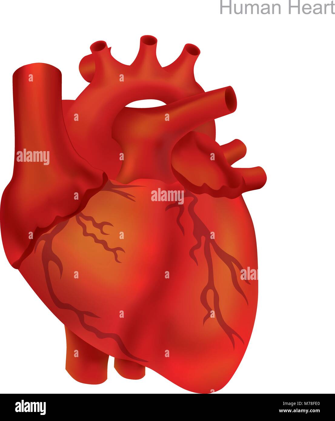 Das Herz des Menschen zu isolieren. Angioplastie ist ein Endovaskuläres Verfahren zu erweitern Arterien oder Venen verengt oder verstopft, in der Regel zur Behandlung von arteriellen atheroscl Stock Vektor