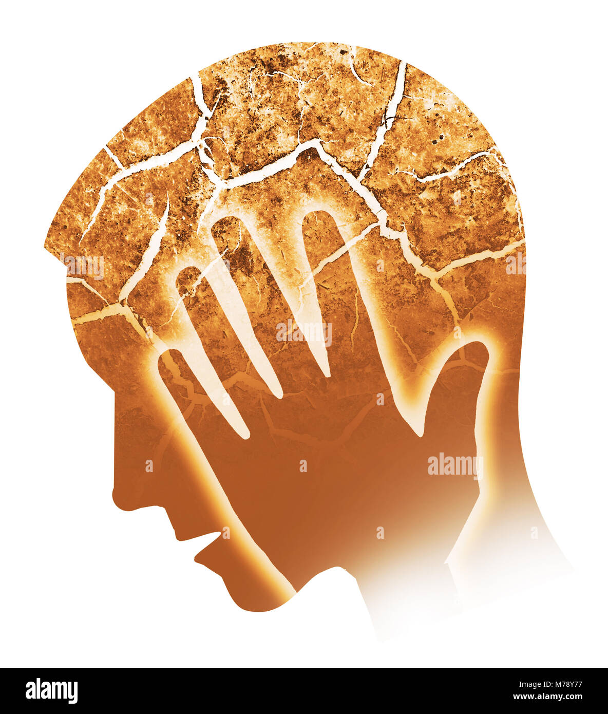 Kopfschmerzen, Migräne, Depression. Männliche Silhouette mit gerissenen Kopf symbolisiert Wahnsinn, Depression, Kopfschmerzen, Schizophrenie. Mann seinen Kopf halten. Isol Stockfoto