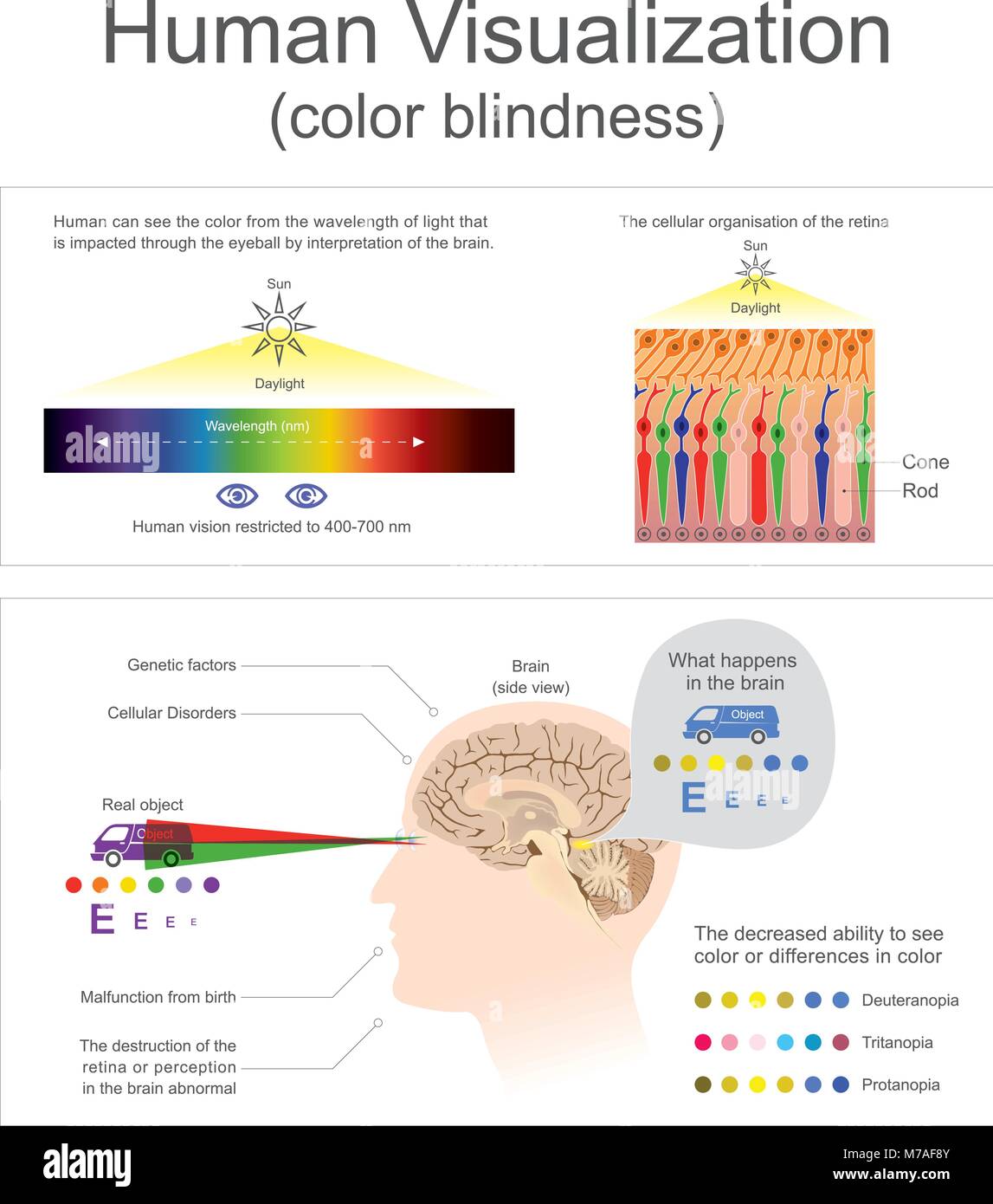 Menschen sehen die Farbe von der Wellenlänge des Lichts die Zerstörung der Netzhaut oder Wahrnehmung im Gehirn abnorme Stock Vektor